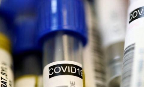 Cientistas europeus testam quatro tratamentos contra novo coronavírus