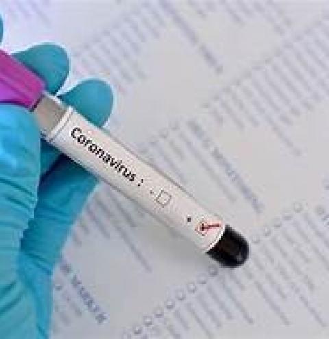 Número de infectados pela Covid-19 segue aumentando em Siqueira Campos